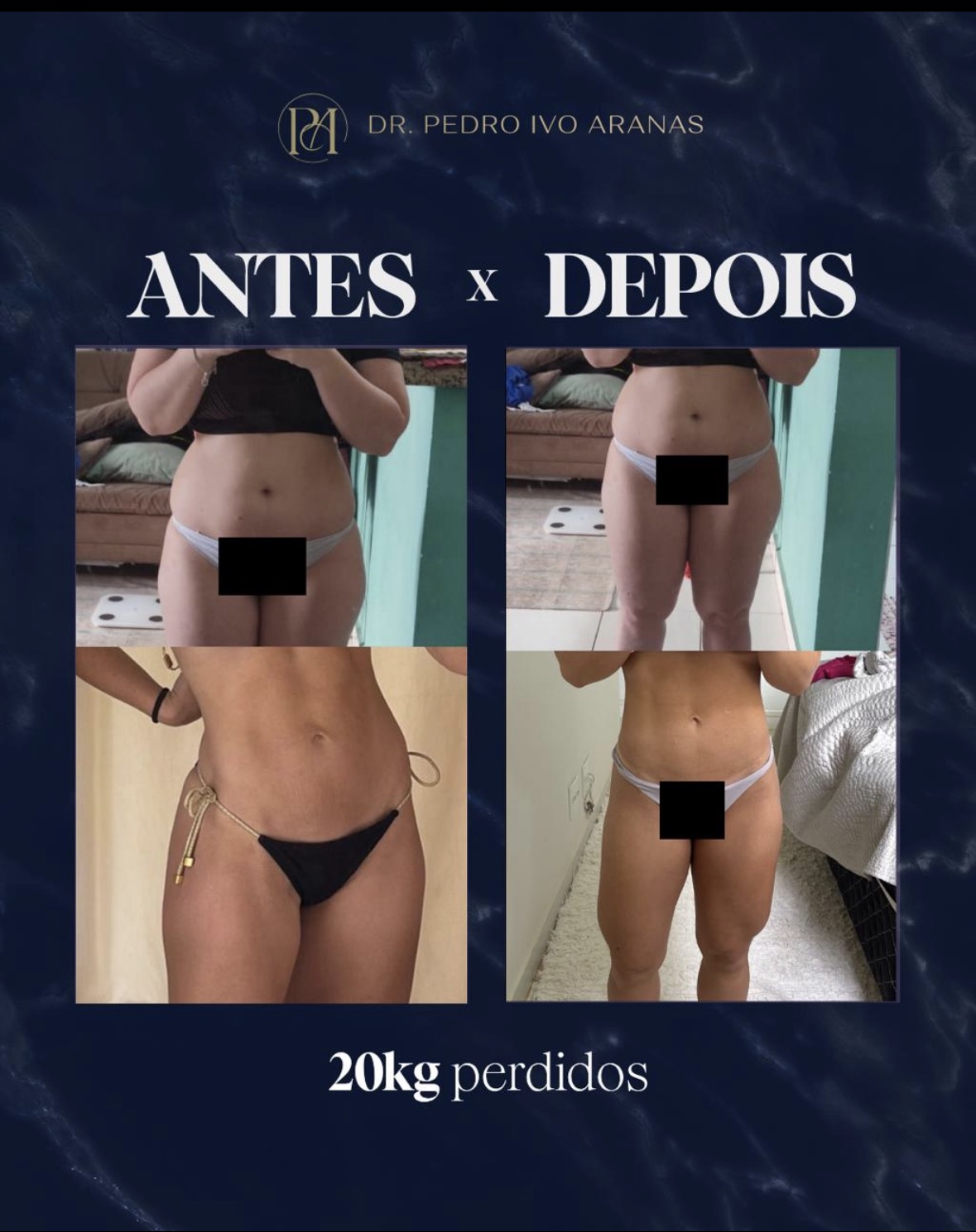 Caso real - Transforma&ccedil;&atilde;o 1